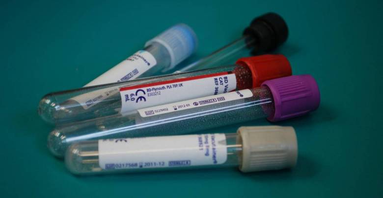 Выявление Covid-19: антигенные тесты стали предлагать в Монако